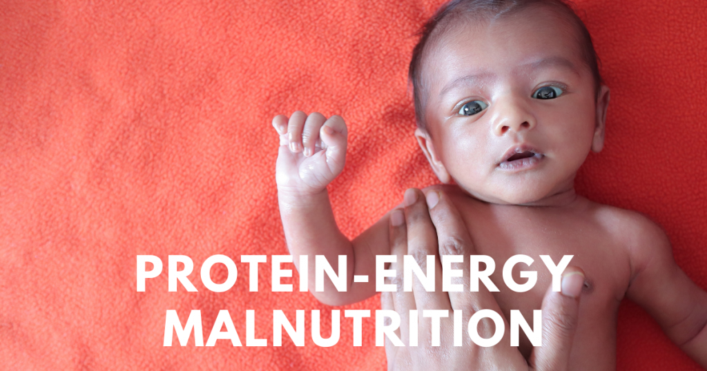 Protein-Energy Malnutrition